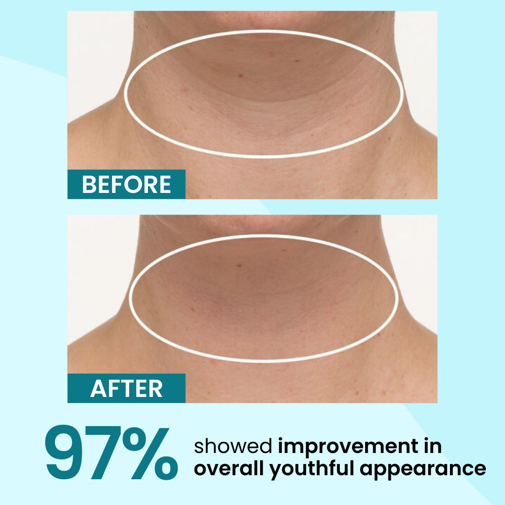 Firm & Smooth Neck Serum